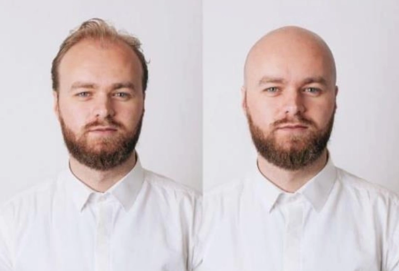 AI Bold Filter Created A Classic Bald Look