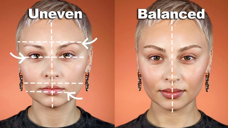 Facial Features Dropping on One Side