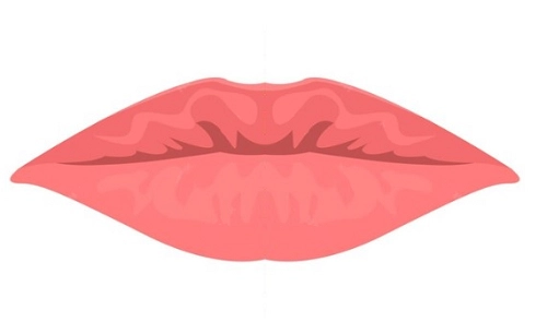 Illustration of Downward-Turned Lips