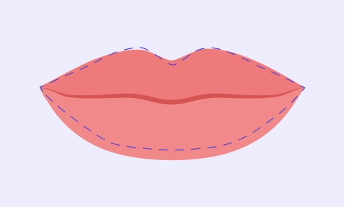 Illustration of Heavy Lower Lips