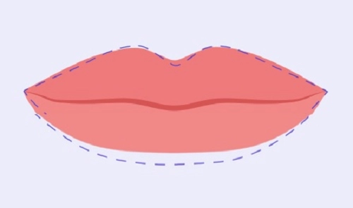 Illustration of Heavy Upper Lips