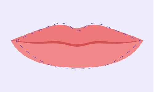 Illustration of Wide Lips